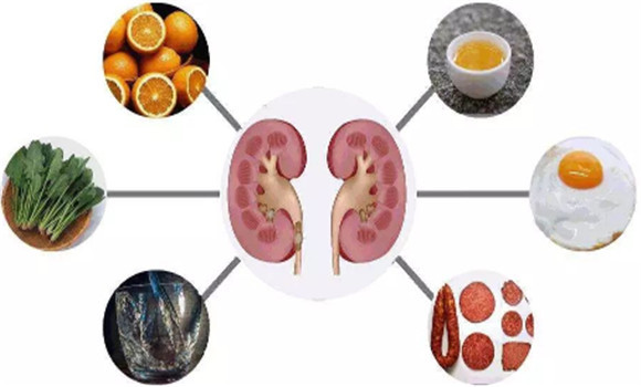 怎樣預防腎結石的發(fā)生